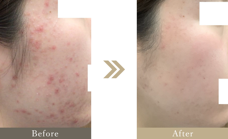 施術前後の画像