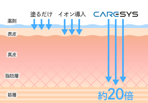 クライオポレーションの治療写真