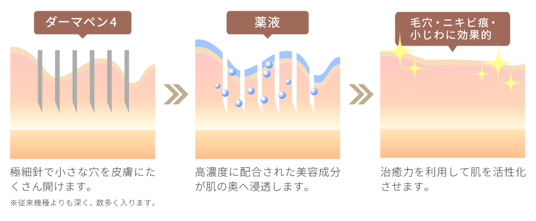 ヴェルベットスキンの仕組み