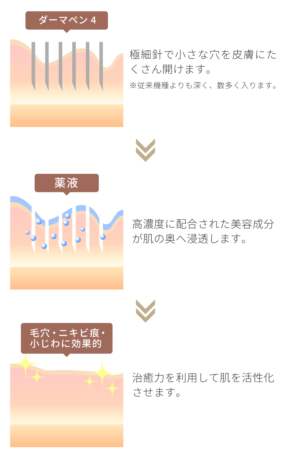 ダーマペン4 - 【天神みきクリニック】福岡市天神・美容皮膚科 / シミ取り・赤ら顔治療