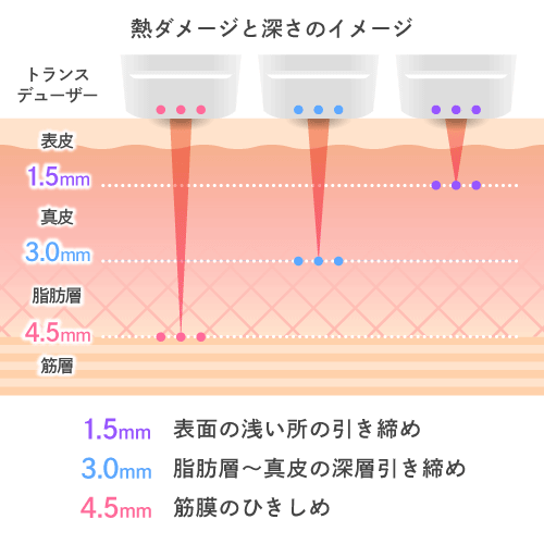 熱ダメージと深さのイメージ