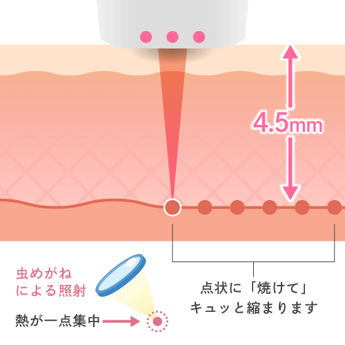 熱ダメージと深さのイメージ