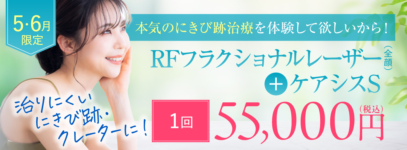 キャンペーンバナー