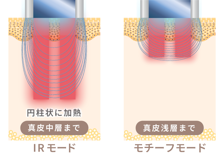 モチーフIRの仕組み