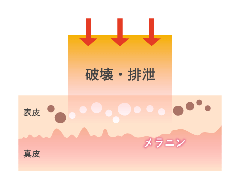 ピコトーニングのイラスト