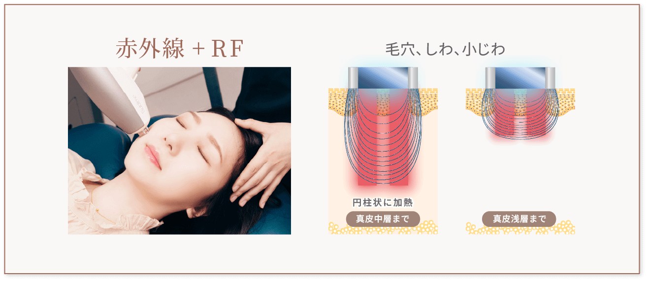 赤外線+RF