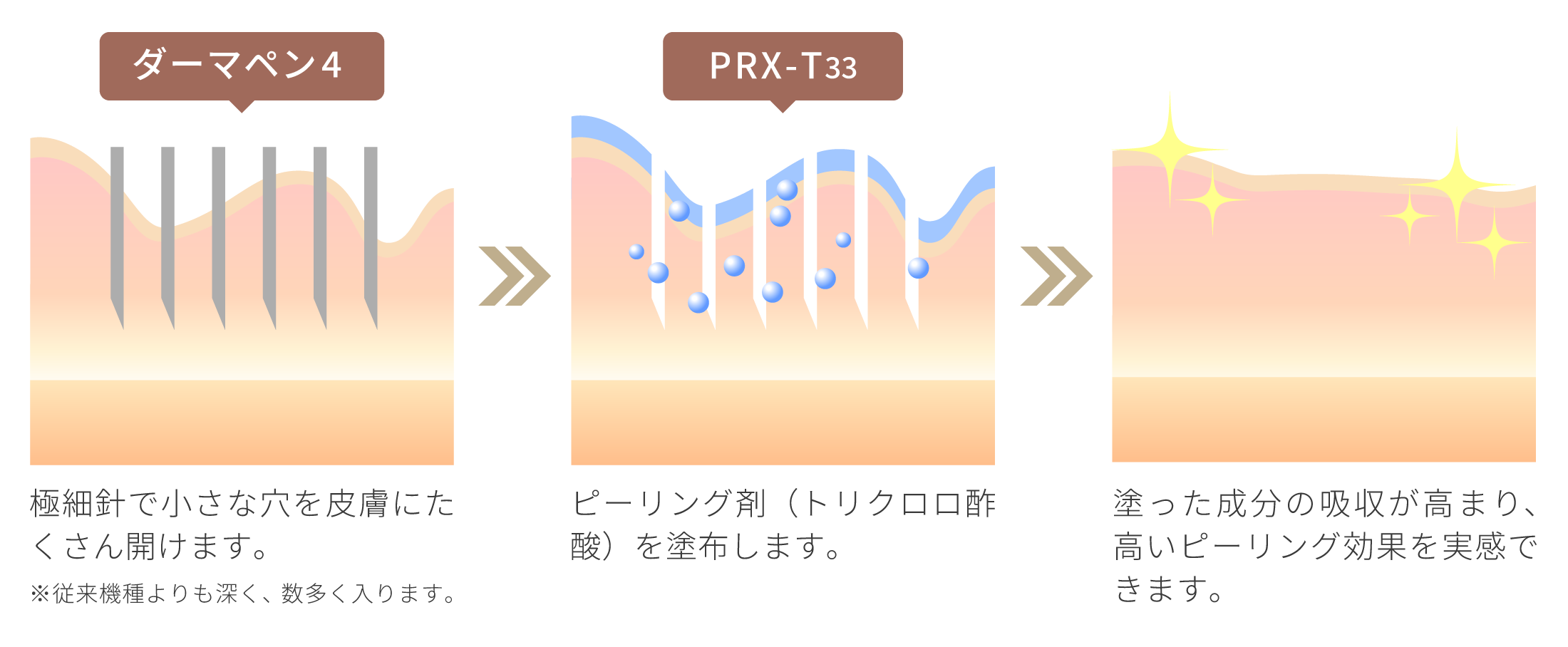 ヴェルベットスキンの仕組み