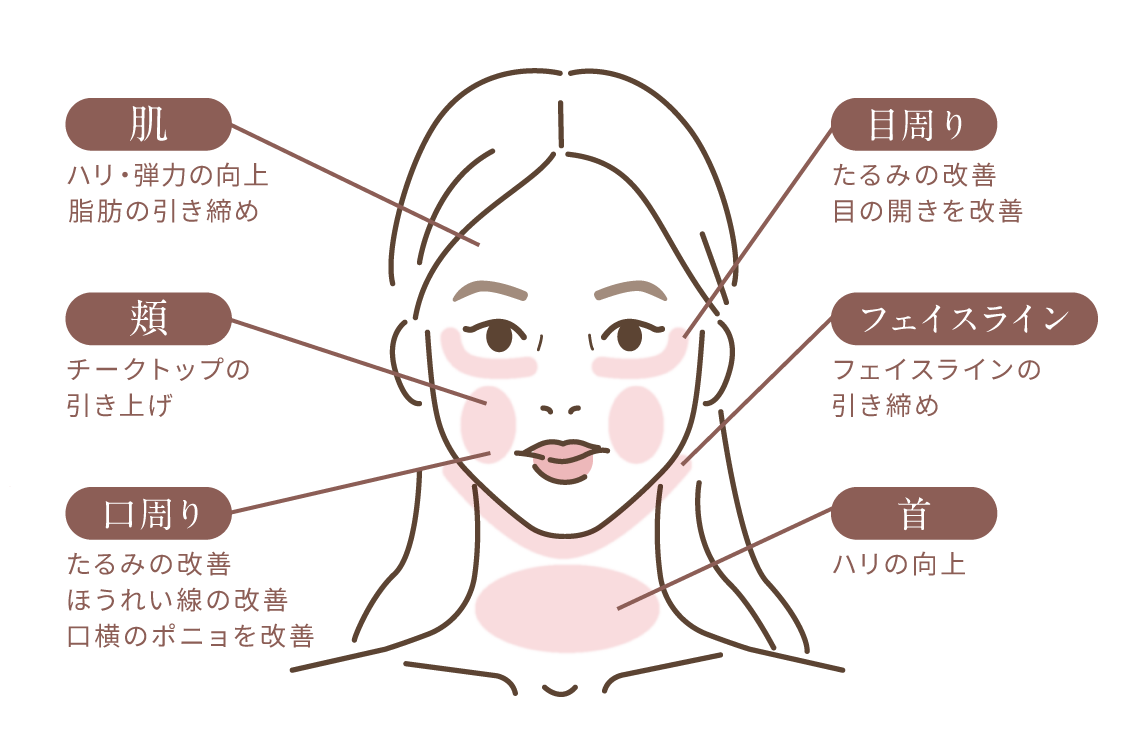熱ダメージと深さのイメージ