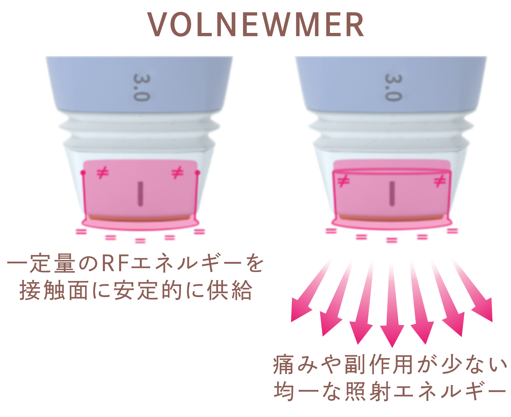 ボルニューマの仕組み