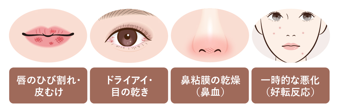 乾燥