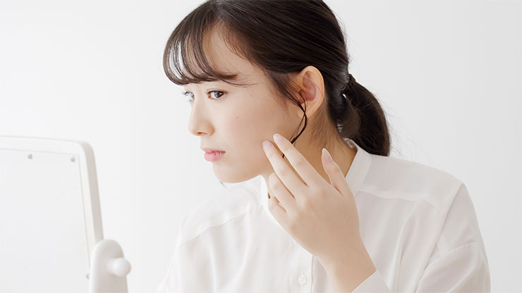 ニキビに悩む女性