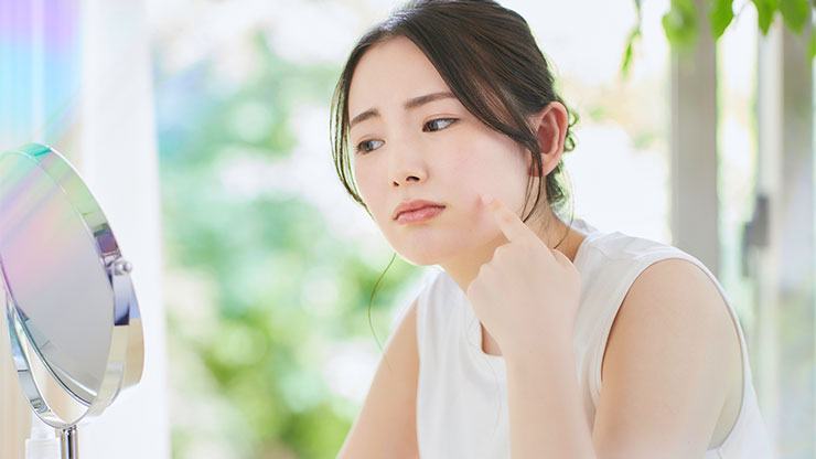 ニキビ跡に悩む女性
