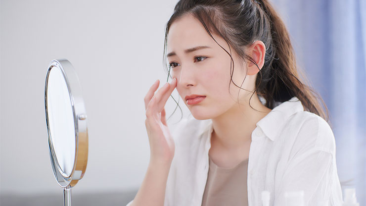 黒ニキビに悩む女性