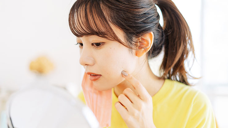 ニキビを気にする女性