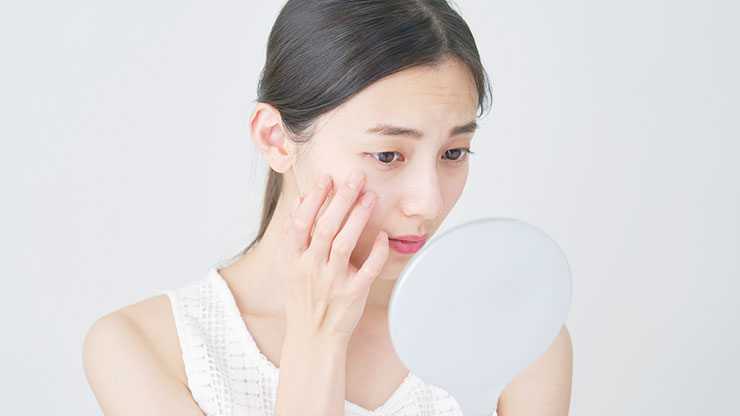 ニキビを即効で治したい女性