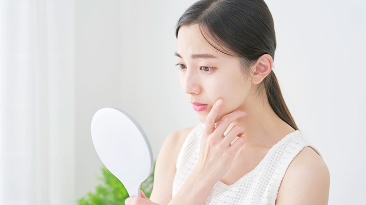 ニキビができやすい女性