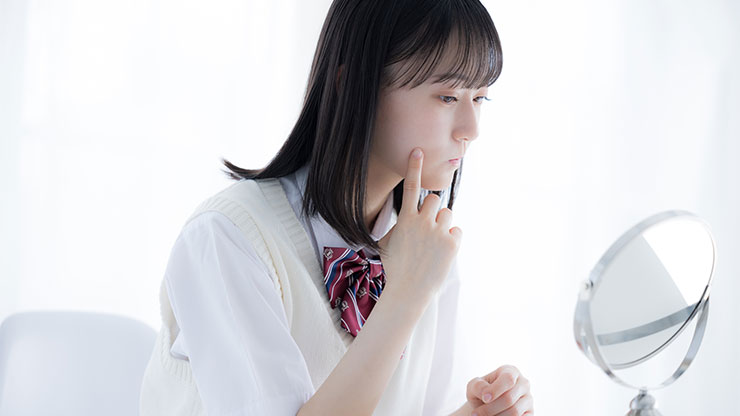 思春期ニキビに悩む中学生
