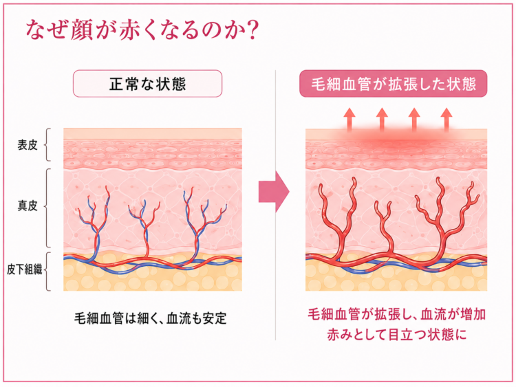 赤ら顔のメカニズム